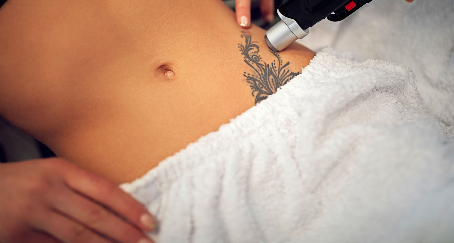 How Does Tattoo Removal Actually Work?: Richard Blanchar, MD: General  Practitioner